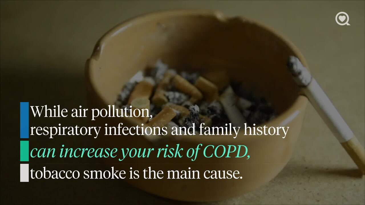 Ron Cephas Jones, ‘This Is Us’ actor, dies at 66 from COPD